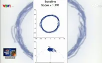 Eye-sync - Thiết bị theo dõi phát hiện chấn thương não trong thể thao