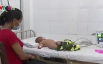 Bệnh nhi nghi mắc viêm não mô cầu ở Đăk Lăk sức khỏe tiến triển tốt