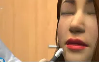 Để selfie đẹp, giới trẻ Mỹ đua nhau bơm môi