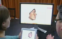 Công nghệ 3D giúp phẫu thuật mũi chính xác hơn