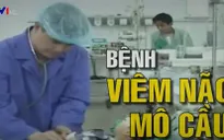 Khuyến cáo phòng chống bệnh viêm não mô cầu