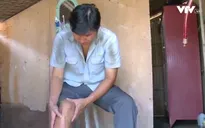 Nghị lực sống của chàng trai bị thương nặng do tai nạn giao thông