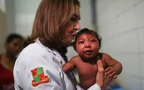 Nghi vấn chứng teo não ở trẻ không do muỗi truyền virus Zika​