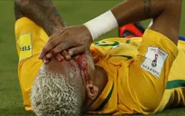 VIDEO Brazil 5-0 Bolivia: Neymar ghi bàn, kiến tạo và ... đổ máu
