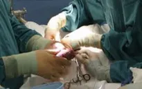 Ấn Độ phá đường dây buôn bán nội tạng