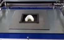 Tự chế niềng răng bằng máy in 3D