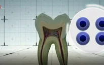 Lưu trữ tế bào gốc từ răng