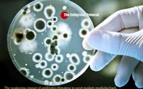 Phát hiện siêu vi khuẩn kháng thuốc tại Mỹ