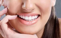 Những điều bạn cần biết để có hàm răng trắng bóng như ngọc trai