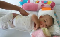 Thương cháu bé 11 tháng tuổi bị bỏng nước sôi nặng