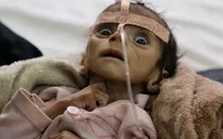 Nỗi ám ảnh phía sau bức ảnh bé trai chết đói tại Yemen