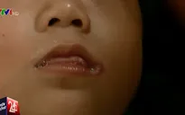 Dịch tay chân miệng vào mùa ở TP.HCM