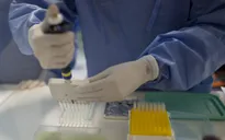 Brazil và Mỹ hợp tác nghiên cứu vaccine phòng virus Zika