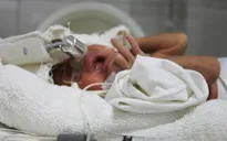 Tiếng khóc khát sống của cậu bé sinh non từ người mẹ bị phát bệnh dại