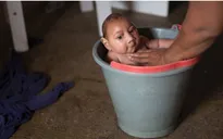 Đồng Nai có nguy cơ nhiễm virus Zika cao