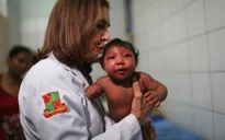WHO: Thêm bằng chứng về virus Zika liên quan đến chứng đầu nhỏ