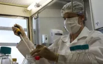 Zika tấn công bào thai trong 3 tháng đầu, não bị thu nhỏ tới 40%