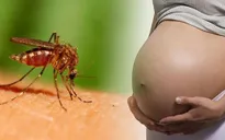 Thái Lan điều tra 4 trường hợp nghi mắc chứng đầu nhỏ do virus Zika