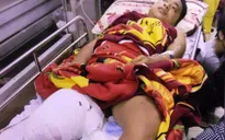 Phải cưa chân vì bác sỹ chẩn đoán... “chấn thương phần mềm”