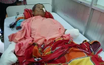 Đăk Lăk: Cuốc phải mìn, 2 cha con mất chân