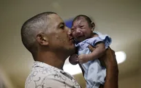 Dị tật đầu nhỏ có thể không phải do virus Zika