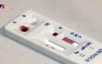 Mỹ thông qua dụng cụ xét nghiệm nhanh virus Zika