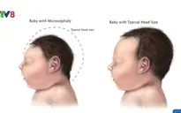 Brazil đầu tư 2,8 triệu USD nghiên cứu virus Zika
