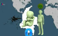 Ca đầu tiên mắc chứng đầu nhỏ nghi do virus Zika tại Việt Nam