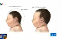 Virus Zika có thể lan tới Pháp