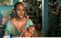 Phụ nữ Brazil vượt lên nỗi đau có con bị ảnh hưởng bởi virus Zika