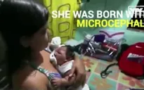 Bé mắc virus Zika may mắn được gia đình khác chăm sóc
