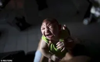 Thêm bằng chứng về sự liên quan giữa virus Zika và bệnh đầu nhỏ