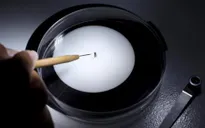 Các nước đẩy mạnh chống virus Zika