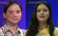 Cô gái bị chàm xinh đẹp bất ngờ tại Change Life - Thay đổi cuộc sống