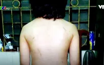 Những vụ bạo hành trẻ em gây chấn động dư luận gần đây