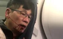United Airlines “trắng án” sau vụ bạo lực hành khách