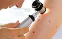 11 dấu hiệu cảnh báo ung thư sớm