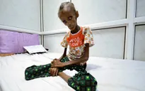 Gần 17 triệu người dân Yemen ăn thực phẩm bẩn