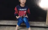 Trái tim cho em: Bé trai 6 tuổi hồi phục tốt sau ca phẫu thuật tim