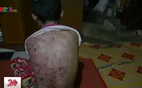 Tình trạng bạo hành đối với lao động trẻ em tại Myanmar