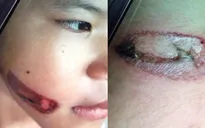 Chưa đến 1 tuần diễn ra 5 vụ bạo hành và sát hại trẻ nhỏ