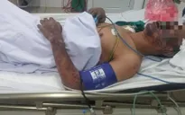 Viêm màng não mủ vì ăn tiết canh lợn do gia đình tự giết mổ
