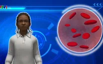 Chữa khỏi ca nhiễm HIV thứ 3 trên thế giới