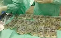 Nuốt 7.000 USD vào bụng vì cãi nhau với chồng