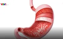 Dấu hiệu nhận biết bệnh ung thư dạ dày