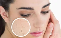 Mùa đông, nên ăn những loại thực phẩm này để tránh khô da