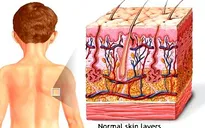 Tây Ban Nha: Độc đáo máy 3D sinh học in da người