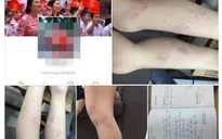 Hà Nội: Tạm đình chỉ giáo viên đánh học sinh tiểu học Nguyễn Tri Phương