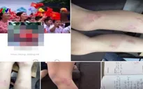 Đề xuất kỷ luật cô giáo đánh học sinh