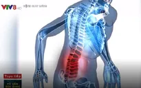 Phương pháp điều trị bệnh đau thắt lưng